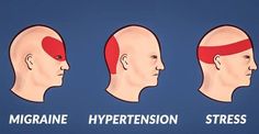 La migraine et les maux de tête génèrent parfois des douleurs qui peuvent rapidement devenir insupportables voire handicapantes. Bonne nouvelle, il existe des méthodes naturelles pour les soulager sans forcément passer par la case médicament. Ainsi, avant... Natural Migraine Relief, Shiatsu Massage Acupressure, Acupressure Therapy, Shiatsu Massage, Massage Benefits