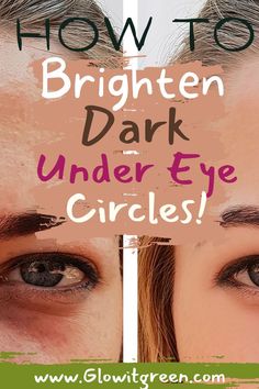 Get tips and ideas from Glowitgreen.com, to relieve the look of heavy, dark undereye circles. while there are  many causes of this problem, find what natural ingredients you can use that are a big help in brightening this area! Dark Under Eye Circles, Dark Undereye, Dark Circles Under The Eyes, Under Eye Circles, Windows To The Soul, Fine Lines And Wrinkles, Dark Circles Under Eyes, Dark Under Eye, Eye Circles