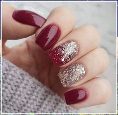 Valentine Nails, Nagel Tips, Christmas Gel Nails, Shellac Nails, Xmas Nails, Christmas Nail