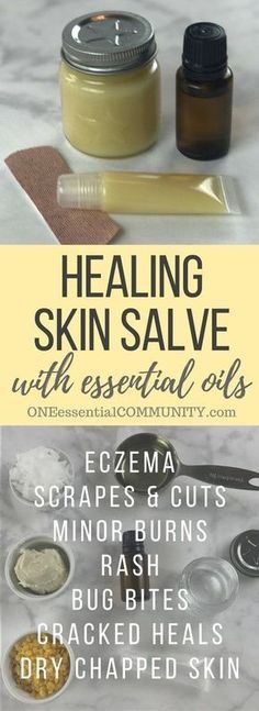 DIY all-purpose essential oil healing skin salve recipe: eczema, chapped skin, cracked heels, minor cuts, bug bites, bee stings, rash, burns, and more. Essential Oil Healing, Healing Salve Recipe, Healing Skin, Salve Recipes, Homemade Essential Oil, Healing Salves, Diy Kosmetik, Cracked Heels, Bug Bites