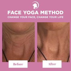 Top 5 Face Yoga Exercises To Reverse Aging - FREE Download Reduce Neck Wrinkles, Facial Workout, Facial Exercise, Face Yoga Method, Face Tone, Facial Cupping, Turkey Neck