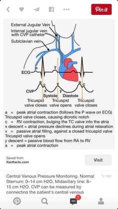 diagram of the heart with valves and ventilators labeled in red, white and blue