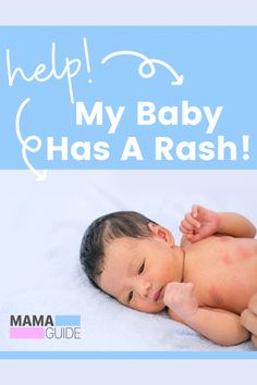 a baby laying on its back with the words help my baby has a rash