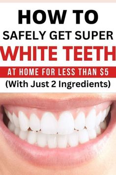 Best hack for super white teeth at home for less than 5 minutes. Whiten Teeth At Home, Natural Teeth Whitening Diy, Teeth Whiting At Home, Teeth Whitening Homemade, Whiten Teeth, Yellow Teeth, Teeth Health