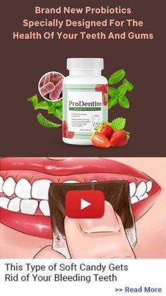 ProDentim Review – Designed For Teeth and Gum Health - Is it Legit? Does it Really Work? #healthteeth #healthteethandgums #prodentim Gum Recession, Tooth Sensitivity, Receding Gums