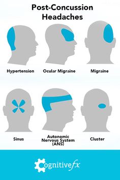 Pressure Headache, Forward Head Posture, Headache Relief, Migraine Headaches, Post Traumatic, Health And Fitness Tips, Brain Health