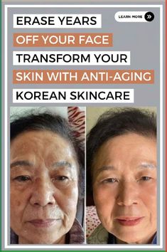 Korean Anti Aging Skin Care, Natural Wrinkle Remedies, Tighten Facial Skin, Antiaging Skincare Routine, Anti Aging Skincare Routine, Wrinkle Remedies, Anti Aging Skin, Anti Aging Tips, Ageless Beauty