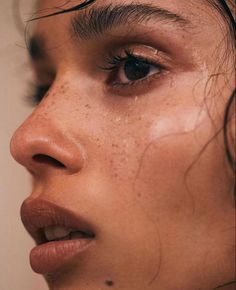 a woman with freckles on her face looking to the side