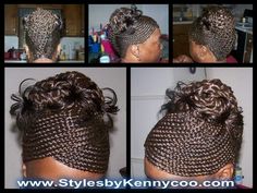 . Alopecia Braid Styles, Black Braided Hairstyles Updos, Corn Braids, Basket Braid, Protective Style Braids, Alopecia Hairstyles, Braided Updos, Braided Hair Styles, Big Box Braids