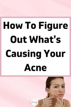 I did a post back when I first started my blog in 2017 (before I relaunched it this year) about how I cleared my severe cystic acne. I’m happy to say that Nodular Acne, Acne Remedy, Acne Women, Cystic Acne Remedies, Clear Your Skin, Treating Acne