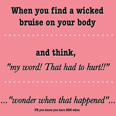 eds pots fibro. Haha yep find a new bruise everyday. No clue how it got there though. Elhers Danlos Syndrome, Fatigue Syndrome, Ehlers Danlos Syndrome, Gym Humor, Look Here