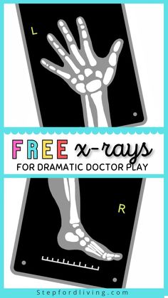 free x - rays for dramatic doctor play