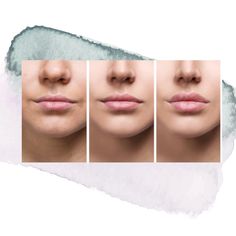 three different stages of lip fillers on a woman's face, including the lips and nose