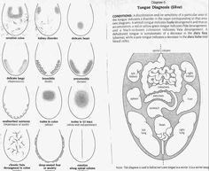 Acupuncture School, Body Points, Vata Diet, Herbal Knowledge, Herbal Health, Health Heal, Medical Anatomy, Holistic Remedies