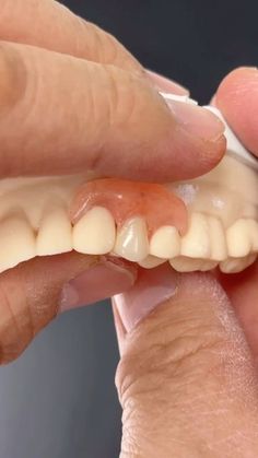 Dental Notes, Dental Prosthesis, Dentist Assistant, Dental Aesthetics, Dental Technician, Teeth Health, Reduce Body Fat, Dental Lab, Tooth Decay