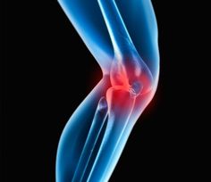 My Knee Hurts, Knee Injury, Home Remedies, Need To Know