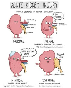 the stages of kidney injury and how they can help you with their treatment medical humor, medical humor, funny cartoons, cartoon pictures, funny pictures to draw, funny pictures for kids, cute, person, doctors, anatomy, doctor stuff, health care, life, brain, nursing,