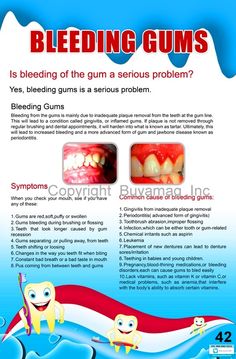 Dental Poster Dental Charts Wall Poster School Education Dentist Wall Posters Implant Orthodontic. Dental Games, Dental Notes, Dental Poster, Happy Dental, General Physician, Education Posters, Dental Education, Dentist Clinic