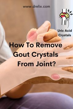 A gout patient has painful gout crystals in his hand fingers Uric Acid Diet, Uric Acid Crystals, Uric Acid Levels, Joints Pain Remedy, Uric Acid, Digestion Problems, Foods To Eat, Knee Pain, Lifestyle Changes