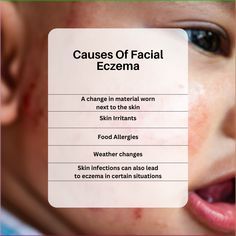 Sometimes a change in lifestyle can cause an onset of eczema and other forms of dermatitis. This applies to eczema on the face but also to other parts of the body as well. #eczema #dermatitis #dermatitiseczema #skintreatment #skincare Rash Care, Laser Acne Scar Removal, Acne Help, Face Care Routine, Acne Scar, Dry Skin Patches, Acne Scar Removal, Parts Of The Body