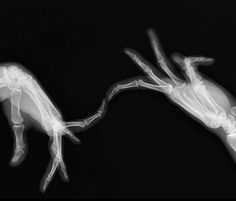 x - ray image of two hands reaching for each other