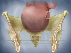 an image of the back of a baby's head and neck with labels on it