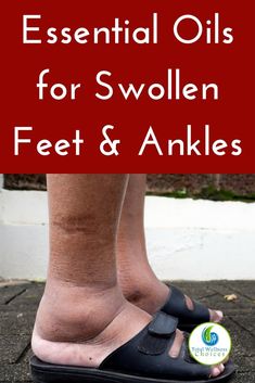 Top 5 Essential Oils for Swollen Feet and Ankles to Reduce Swelling! Essential Oil For Swelling, Essential Oils For Inflammation, Water Retention Remedies, Swollen Ankles, Essential Oils For Pain, Essential Oil Remedy, Reduce Swelling, Essential Oils Health, Living Essentials Oils