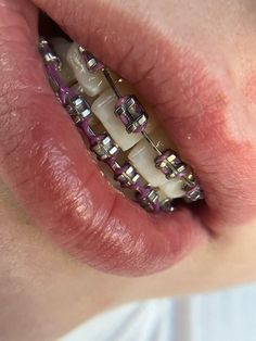 Jewelry Teeth, Braces Smile, Teeth Gems, Delicious Healthy Food