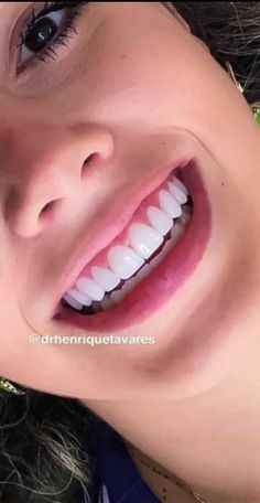 Perfect Teeth Smile, Teeth Products, Perfect Smile Teeth, Smile Tips, Selfcare Goals, Teeth Aesthetic, Youtuber Dr, Pretty Teeth, Veneers Teeth