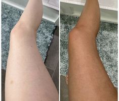 You Bronze Sunless Tanner Before & After #sunlesstan #sunlesstanner #selftanner Pandora Chain Bracelet, Tiktok Affiliate, Loving Tan, Tanning Beds, Burts Bees Lip Balm, Houses Interior, Skin Goals, Tanning Mitt