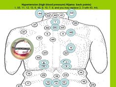 Acupuncture Points, Diagram Design, Holistic Remedies, Healing Hands