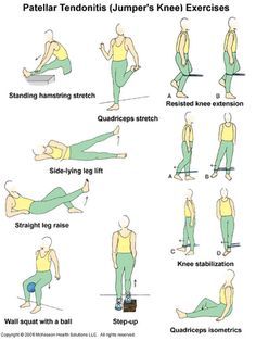 Patellofemoral Pain Syndrome Exercises, Patella Femoral Syndrome, Jumpers Knee, Patellofemoral Pain Syndrome, Runners Knee