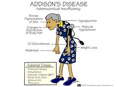 an old woman with the words adhdon's disease and her name on it