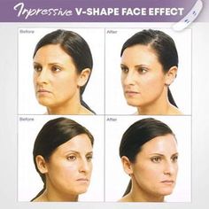 V Shape Face, Beauty Makeup Tips, Womens Clothes, Sagging Skin