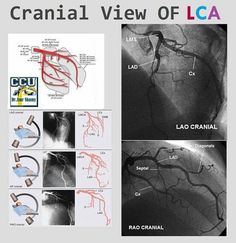 an image of the cranial view of loca with pictures and captions