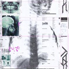 an image of the back side of a human skeleton