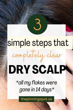 Are you struggling with an itchy, flaky scalp? Discover DIY tips and remedies to achieve a healthy scalp. We’ve gathered the best scalp health tips to help you banish scalp flakes and itchiness for good and say hello to a healthier scalp. You'll learn three simple yet effective steps to completely clear your dry scalp and how to have a scalp care routine that tackles dryness and flakes head-on.  No more flakes, just a healthy, nourished scalp Natural Dry Scalp Remedy, Itchy Dry Scalp Remedy, Get Rid Of Dry Scalp, Extremely Dry Scalp, Itchy Scalp Remedy, Dry Scalp Remedy, Itchy Flaky Scalp, Dry Flaky Scalp, Shampoo For Dry Scalp