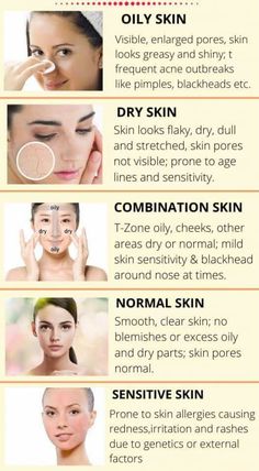 Skin Facts, Dry Skin On Face, Types Of Skin, Skin Allergies, Body Scrubs, Dry Skin Care