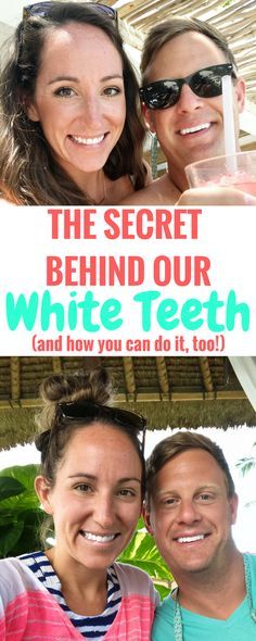 White Teeth Overnight, Diy Teeth Whitening, Whiten Teeth At Home, Diy Teeth, Toddler Tooth Decay, Baby Bottle Tooth Decay, Grooming Hacks, Get Whiter Teeth, Kitchen Staples