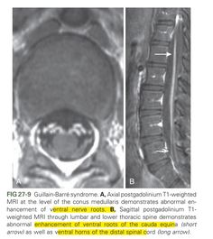 an x - ray image shows the location of the medial area in the left side of the