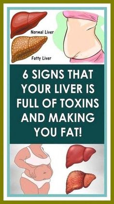 6 Signs That Your  - Liver Is Full Of Toxins by leoni CURYES | This newsletter was created with Smore, an online tool for creating beautiful newsletters for educators, businesses and more Face Wrinkles, Warning Signs, Weights Workout, Online Tools, Wrinkles, Signs