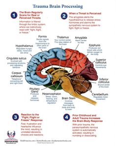 the human brain is labeled in several different languages, including one for each part of the brain