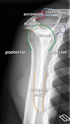 an x - ray shows the different types of bones