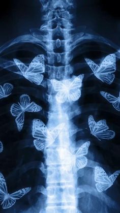 x - ray image of butterflies in the back of a human torso, with an x - ray behind it