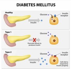 Types Of Insulin, Nursing School Notes, Anatomy And Physiology, Biochemistry, School Essentials