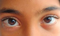 a close up of a person's eyes with brown and blue colored contactions