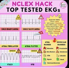 Patient Care Technician, Nurse Notes, Nurse Teaching, Cardiac Rhythms, Nursing 101, Nursing Board, Nclex Review