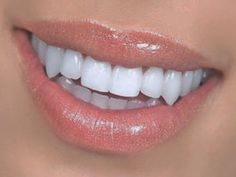 Teeth Claim, Sharp Canine Teeth Human, Natural Fangs Teeth, Loose Teeth, Teeth Aesthetic, Pretty Teeth, Canine Tooth, Maximum Ride, La Girls