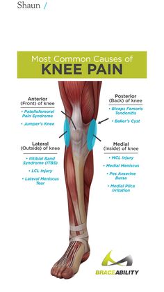 Knee Anatomy, Bursitis Knee, Patellofemoral Pain Syndrome, First Aid Training, First Aid Cpr, Body Chart, Rehabilitation Exercises, Pain Relief Remedies, Body Action