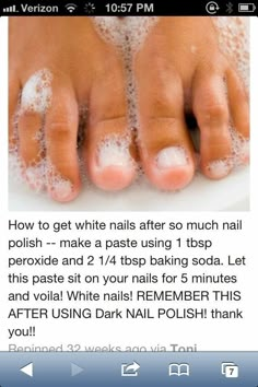 Whiten dark or stained nails #fingernails #toenails #whiten #beauty #recipes Stained Nails, Skin Care Routine For 20s, Pinterest Nails, Pinterest Diy, Beauty Remedies, Homemade Beauty Products, Hacks Diy, Health And Beauty Tips, Pavlova